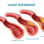 Kolesterol Tinggi Dan Risiko Penyakit Jantung: Wajib Diketahui