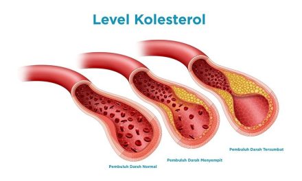 Kolesterol Tinggi Dan Risiko Penyakit Jantung: Wajib Diketahui